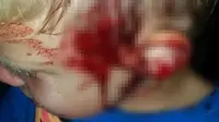 Seorang ibu kaget mendapati putranya berdarah diserang ular piton sepanjang 3 meter