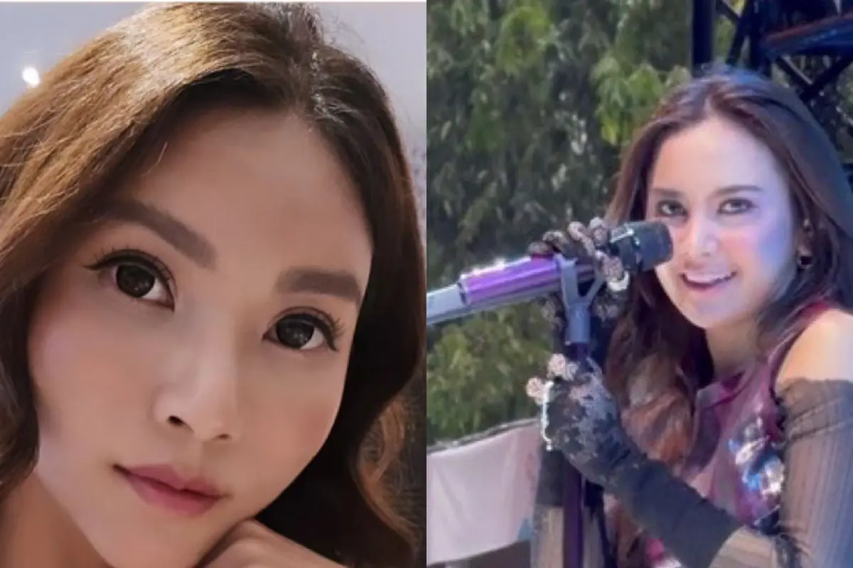 Hasil operasi plastik para artis di Korea Selatan