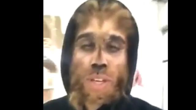 Pria Ini Operasi Wajah  Agar Mirip Serigala  Health 