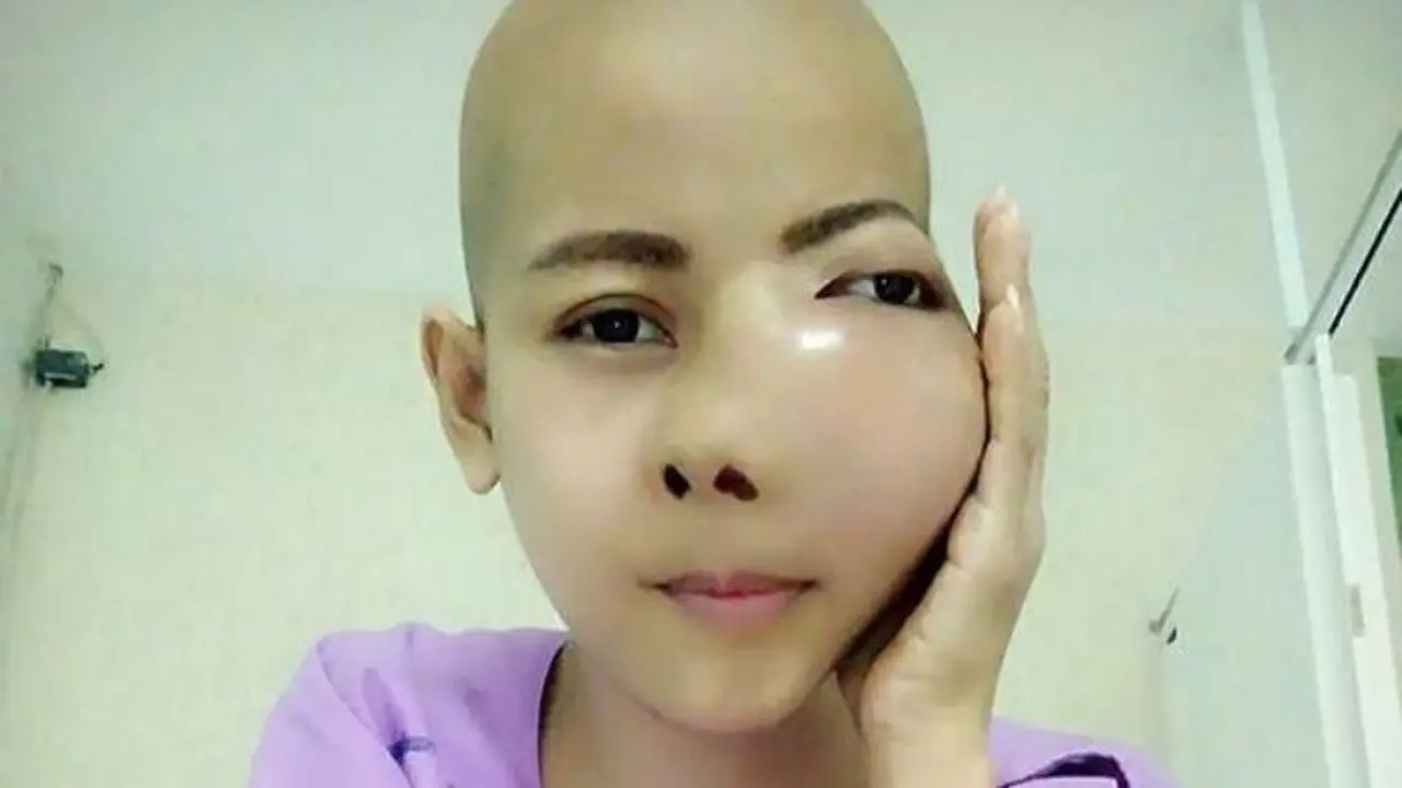 Seorang wanita asal Thailand, Jenny Yoo (27) tak meyangka mengidap kanker setelah sakit gigi