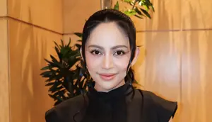 Rachel Vennya Bagikan Kondisi Tangan Usai Jari Manis Bengkak dan Tangan Kiri Melepuh