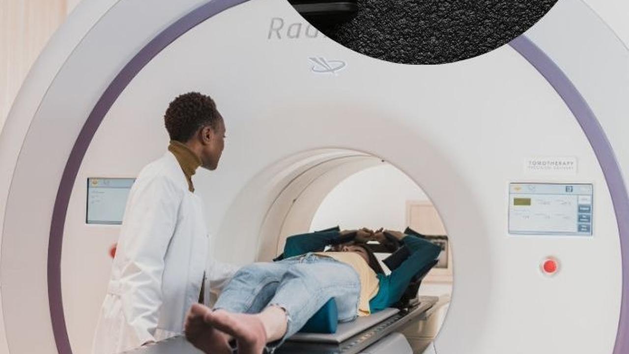 Begini Nasib Seorang Wanita Gara-gara "Nekat" Bawa Pistol saat Diperiksa Mesin MRI