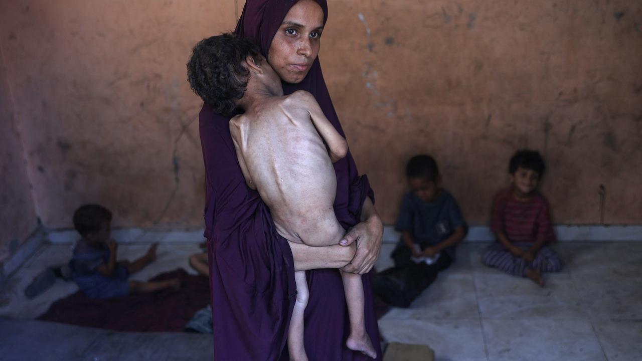 FOTO: Tubuh Kecil yang Lapar, Potret Pedih Bayi Gaza di Tengah Ancaman Kelaparan Massal