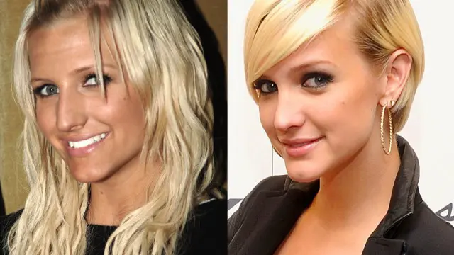 Selebriti Hollywood dan Hidung Barunya