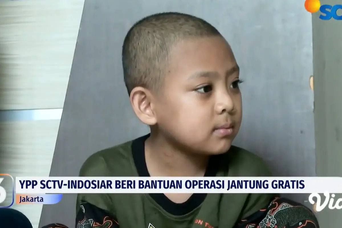 Anak Penjual Cilok Alami Kelainan Jantung, YPP SCTV-Indosiar Beri Bantuan Operasi Jantung Gratis