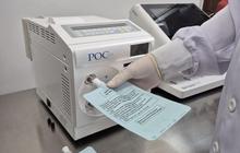 UBT Deteksi H.pylori: Metode Non-Invasif Unggul untuk Diagnosis Dini Infeksi Lambung