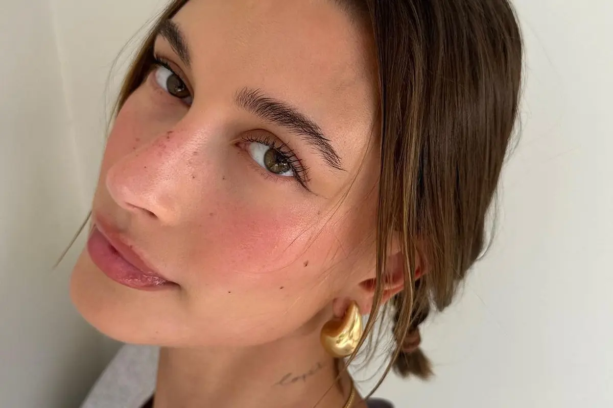 Buka-bukaan Kondisi Kulit, Begini Skincare Routine Hailey Bieber dalam Merawat Dermatitis Perioral