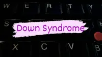 Down Syndrome. Foto: Ade Nasihudin (3/10/2020).