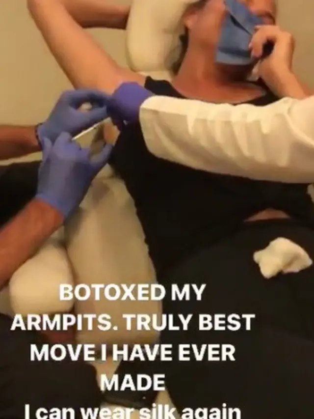 Chrissy Teigen saat melakukan botoks ketiak
