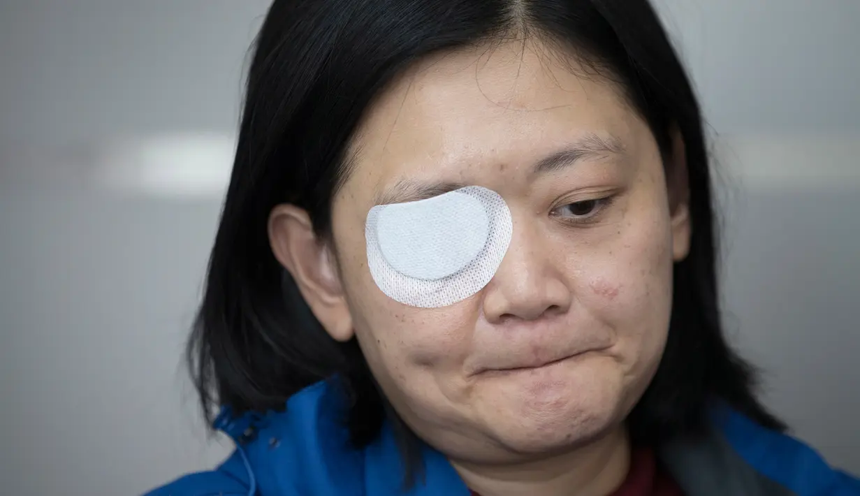 Jurnalis  Indonesia yang tertembak di Hong Kong, Veby Mega Indah saat wawancara dengan The Associated Press di distrik Wan Chai pada 4 Desember 2019. Veby (39), mendesak kepolisian setempat membuka identitas anggota polisi yang menembaknya agar ia bisa menggugat secara pribadi. (AP/Vincent Thian)