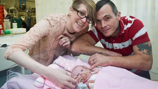 Organ Jantung Keluar Dari Tubuh, Bayi ini Tetap Selamat