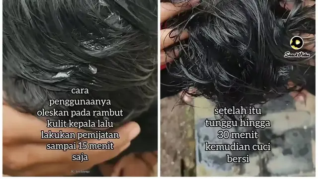 Cara Pemakaian Ramuan Penumbuh Rambut