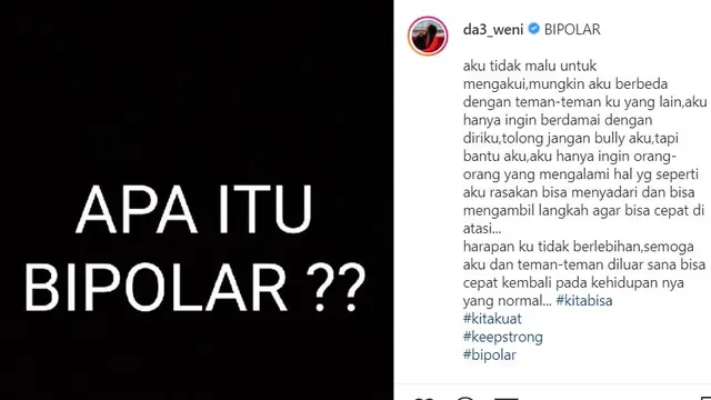 Pengakuan Weni D'Academy mengenai idap bipolar (https://www.instagram.com/p/B9eD5xTgF2N/)
