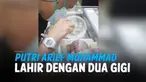 vertical arief