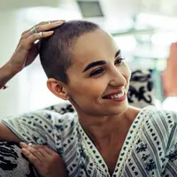 ilusrtrasi perempuan alopecia/copyright by KIRAYONAK YULIYA (Shutterstock)