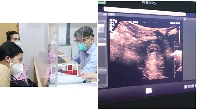 Hamil Anak Pertama, Ini 7 Momen Haru Felicya Angelista Kabarkan ke Keluarga