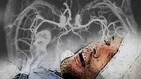 Stroke Bisa Dicegah dengan Nitrogen Monoksida
