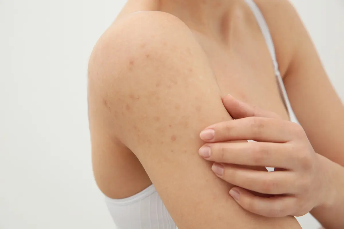 skincare-kezo