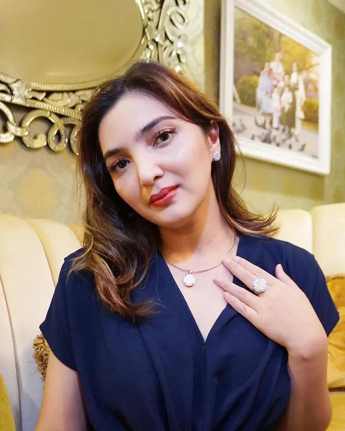 7 Artis Pernah Idap Penyakit di Otak, Aurelie Moeremans Alami Penyusutan Otak