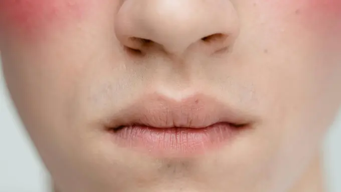 Makeup Sering Cakey? Ini Tips Makeup Anti Cakey pada Kulit Kering