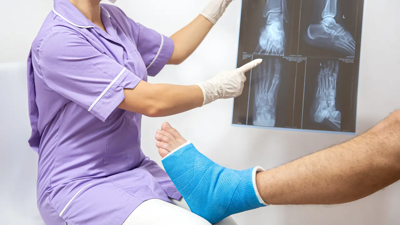 Osteoporosis Kerap Diabaikan, Dokter: Padahal Bisa Dicegah
