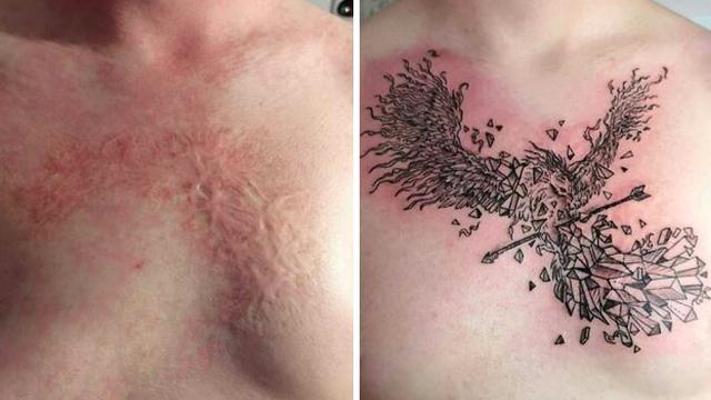 tutupi bekas luka dengan tato