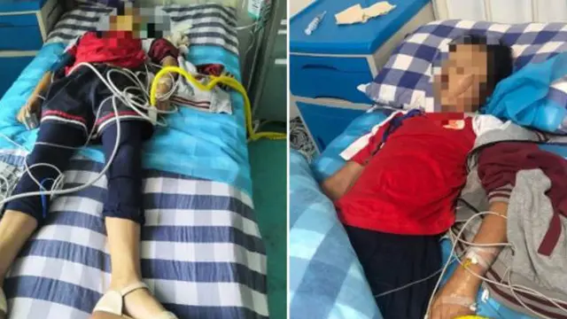 Salah Jawab Soal Matematika, Siswa SD Dihukum Gurunya hingga Tewas