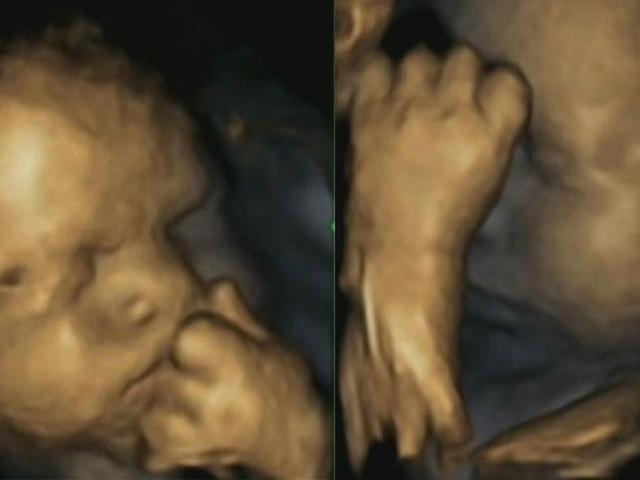 Ibu Hamil Stres Bayi Di Kandungan Jadi Sering Sentuh Wajah Health Liputan6 Com