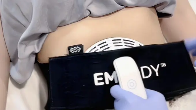 Embody