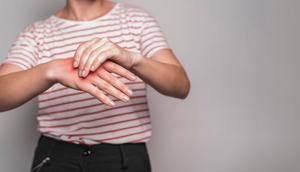 Asam urat tinggi di tangan (Foto: freepik)