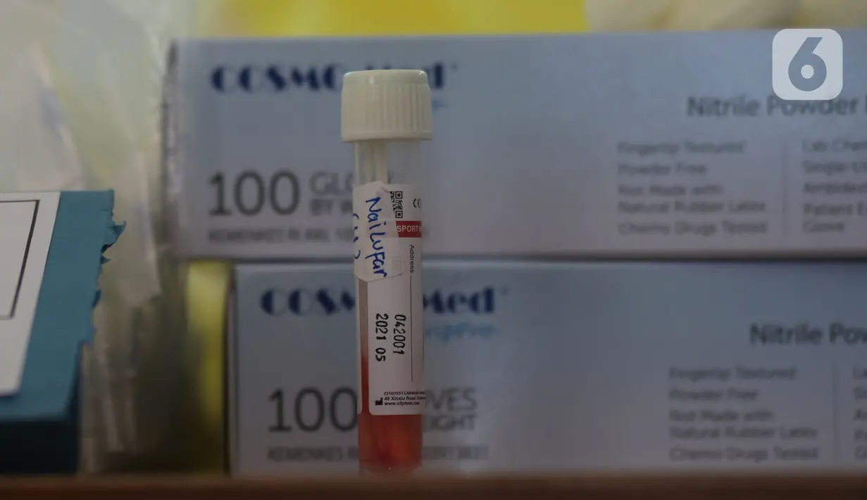 Salah satu sampel saat Swab Test COVID 19 bagi ibu hamil oleh petugas medis Puskesmas Kecamatan Kramat Jati di Jakarta Timur, Jumat (12/6/2020). Tes yang menjadi salah satu syarat untuk menjalani persalinan ini diikuti sekitar 70 ibu hamil. (merdeka.com/Imam Buhori)