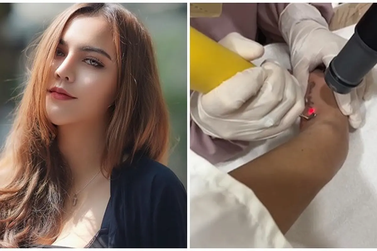 Demi Anak, Ini 6 Momen Ratu Rizky Nabila Hapus 13 Tatonya