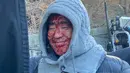 <p>Juwonn dengan wajahnya yang berdarah-darah akibat berkelahi dengan kurang lebih 100 gengster yang mengintai nyawanya. Senyumnya di foto ini berbanding terbalik dengan adegannya. (Foto: Instagram/ ryuseungryong_)</p>
