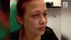 Catt Gallinger, wanita asal Ottawa Kanada ini menato matanya. Ia mengalami pembengkakan dimata. Lantaran kurang benar penorehannya, wanita ini mengeluarkan air mata berwarna ungu.