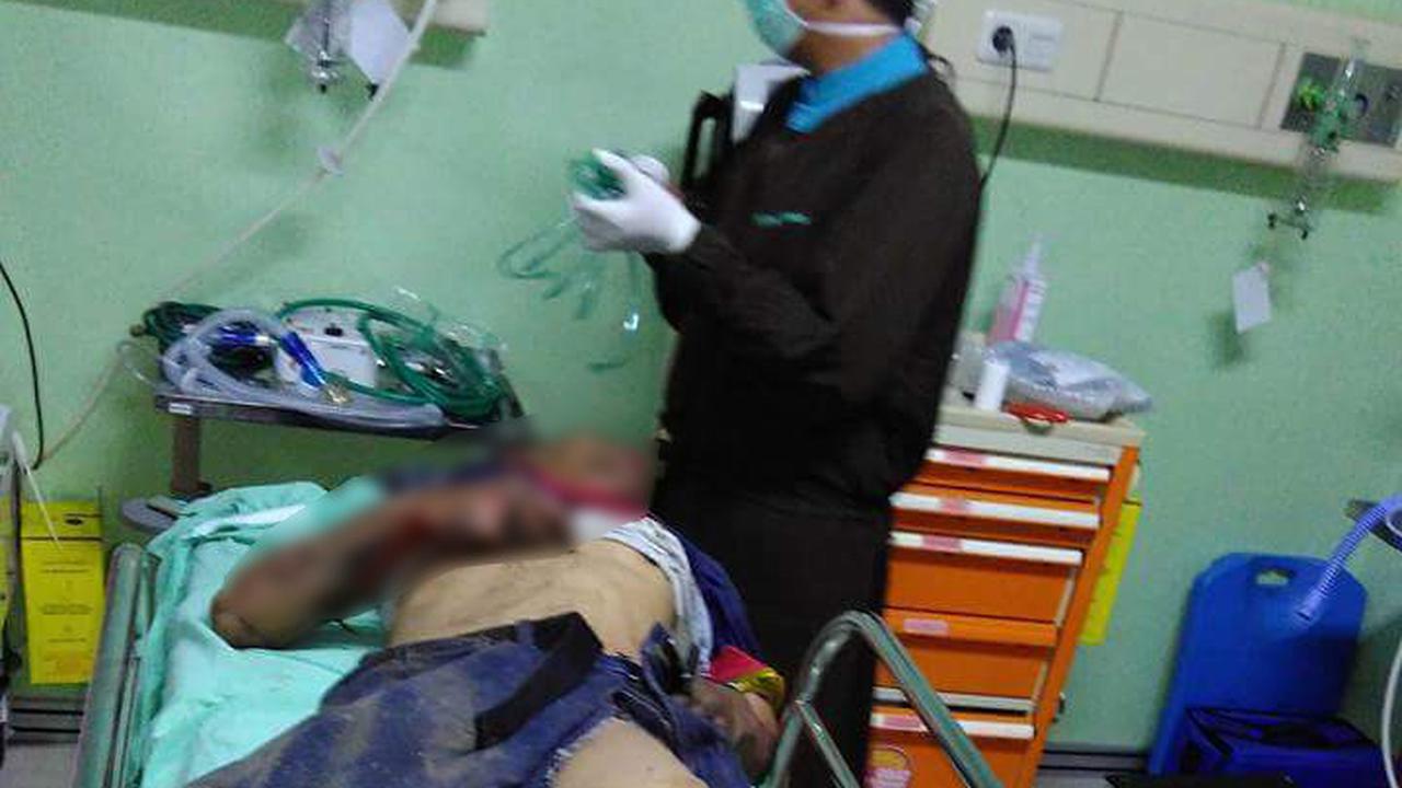 Kernet Truk Tangki BBM Meledak Susul Teknisi ke Alam Baka