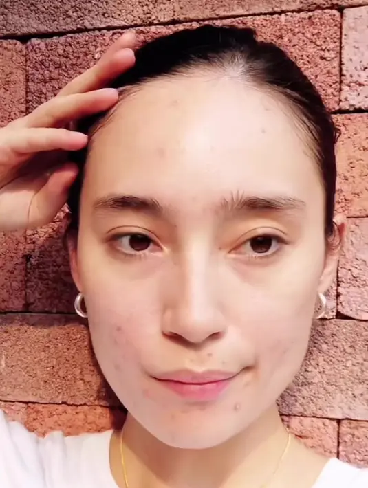 Namun ia juga sama seperti perempuan lain yang punya masalah dengan jerawat. [Instagram.com/tatjanasaphira]