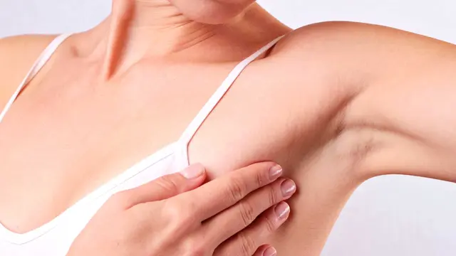 Benjolan pada Payudara Belum Tentu Kanker