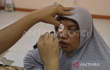 Waspada, Penggunaan Obat Tetes Mata Steroid Sembarangan Bisa Picu Katarak Dini
