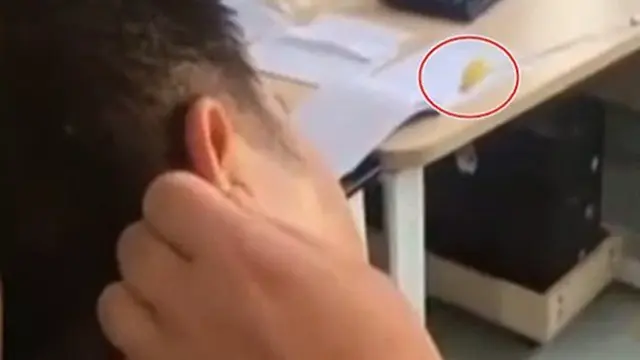 Pakai Bawang Putih ke Telinga Saat Susah Tidur, Pria Ini Alami Nasib Nahas