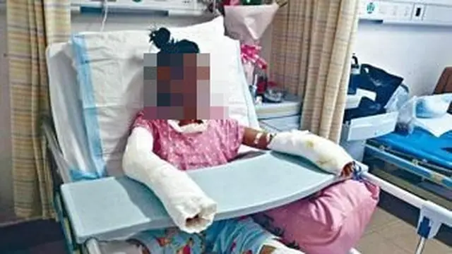 Ikuti Cara YouTuber Memasak, Remaja Ini Alami Hal Tak Terduga