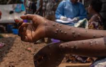 Antisipasi Mpox, Jokowi Minta Perketat Pengawasan Pintu Masuk Internasional Seperti Saat Covid