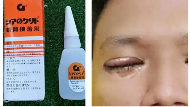 Lem Korea