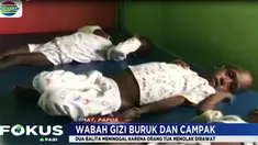 Dua balita kembali meninggal dunia, penyebabnya kedua orang tua balita menolak anaknya diinfus dan diberikan oksigen.