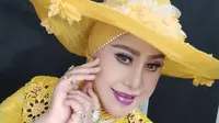 Elvy Sukaesih dan Wirdha Sylvina Berdamai, Kenang Momen Saat Kembali Bertemu 