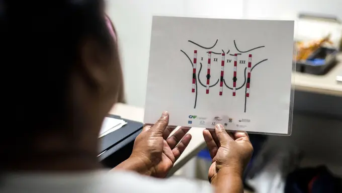 Menggunakan Pita Braille, Petugas Tunanetra Deteksi Kanker Payudara