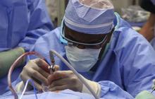 Google Glass bantu dokter membuka penyumbatan darah pasien
