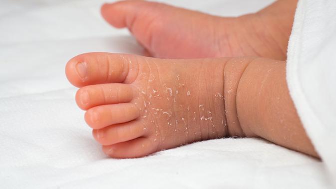 Ilustrasi vernix pada kulit bayi. (Foto: iStockphoto)