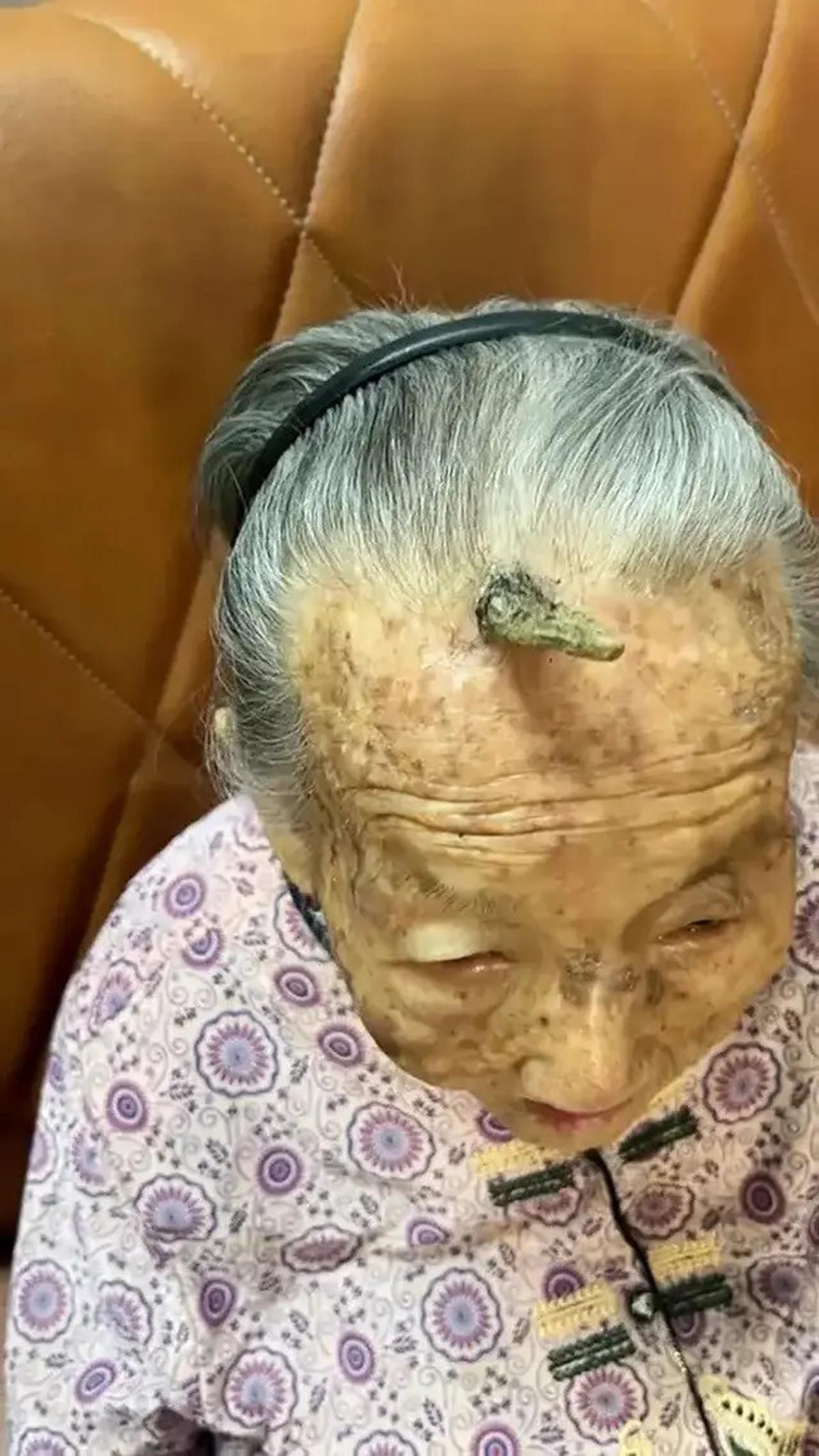 Viral Dahi Nenek 107 Tahun Ini Tumbuh Tanduk, Disebut Bikin Panjang Umur