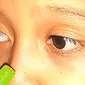 5 Gangguan Retina Mata yang Bisa Picu Disabilitas Netra, Simak Cara Mencegahnya. Foto: Liputan6.com/Ade Nasihudin.