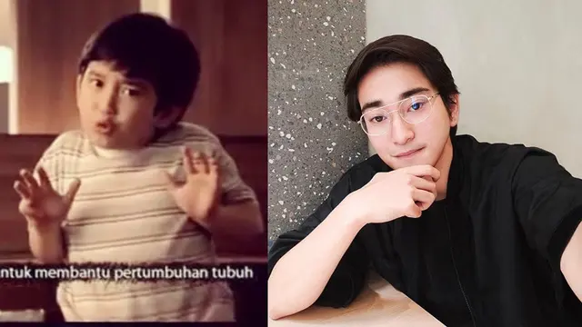Transformasi 6 Bintang Iklan Cilik, Penampilannya Kini Bikin Pangling